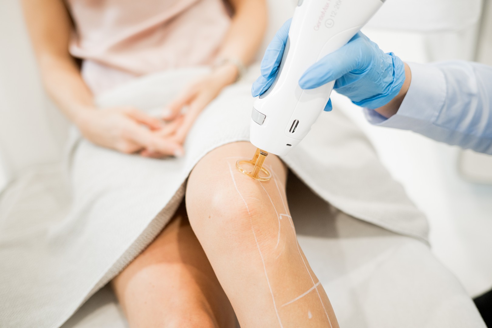 berger_laserhaarentfernung_regensburg_candela_gentlemax_pro_plus_dauerhaft_haare_entfernen_wax